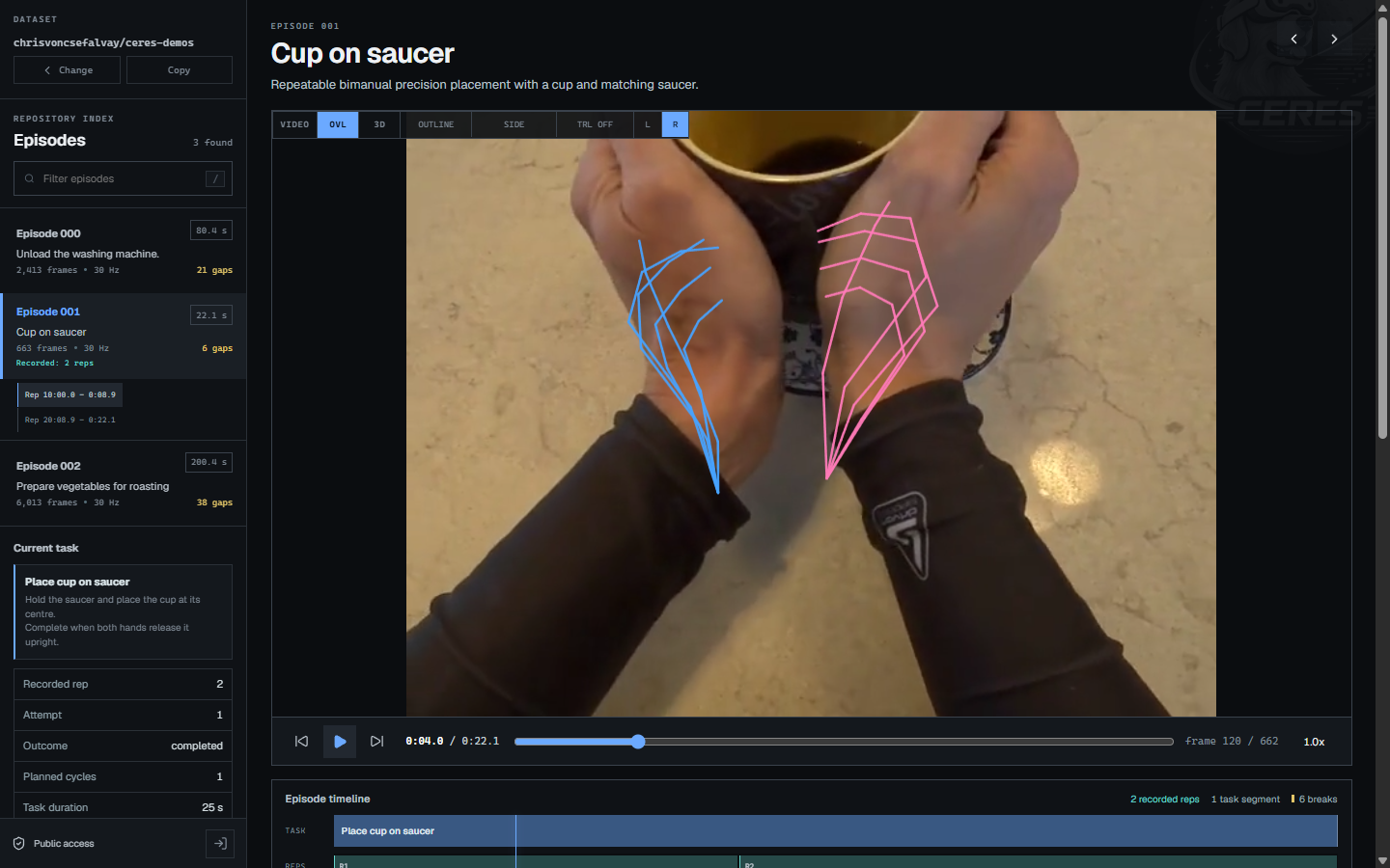 Recorded left and right hand outlines aligned with the outward video in OVL mode